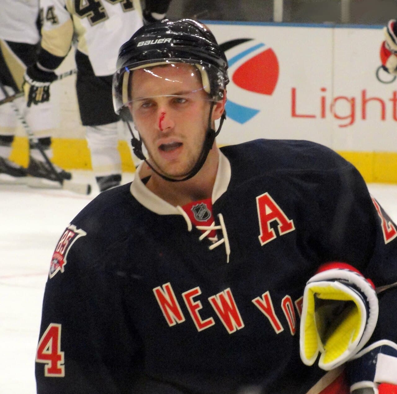 Ryan Callahan of the New York Rangers skates back to the bench with a bloody nose, the result of a high stick from…